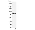 Western blot testing of FLI1 antibody and Lane 1: Jurkat; 2: Raji cell lysate. Predicted/observed molecular weight: ~51kDa.