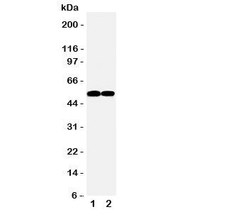 Western blot testing of FLI1 antibody and Lane 1: Jurkat; 2: Raji cell lysate. Predicted/observed molecular weight: ~51kDa.