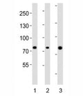 Western blot analysis of lysate from human 1) ovary, 2) placenta and 3) plasma lysate using Integrin beta 8 antibody diluted at 1:1000. Predicted molecular weight: 85/71 kDa (isoforms 1/2).