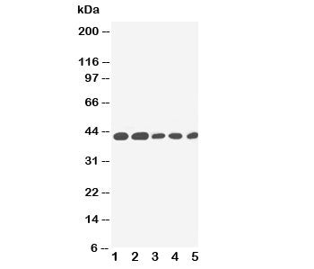 Western blot testing of IL-2 Receptor antibody and Lane 1: PANC; 2: HeLa; 3: Jurkat; 4: Raji; 5: CEM cell lysate. Expected size: 42KD