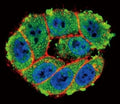 Confocal immunofluorescent analysis of PKC alpha antibody with HeLa cells followed by Alexa Fluor 488-conjugated goat anti-rabbit lgG (green). Actin filaments have been labeled with Alexa Fluor 555 Phalloidin (red). DAPI was used as a nuclear counterstain (blue).