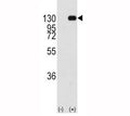 Western blot analysis of FGFR antibody and 293 cell lysate (2 ug/lane) either nontransfected (Lane 1) or transiently transfected with the FGFR1 gene (2). Predicted molecular weight: 75-160 kDa depending on glycosylation level.