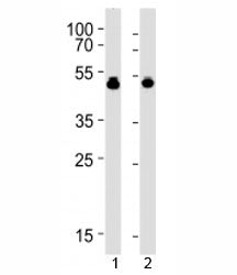 VASP antibody western blot analysis with 1) HUVEC and 2) THP-1 lysate. Expected molecular weight: ~40/46-50 kDa (unmodified/phosphorylated).