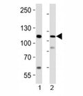 Western blot analysis of lysate from 1) human LNCaP cell line and 2) mouse lung tissue using PRDM16 antibody at 1:1000.