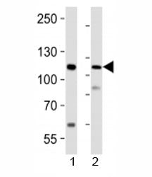 Western blot analysis of lysate from 1) human LNCaP cell line and 2) mouse lung tissue using PRDM16 antibody at 1:1000.