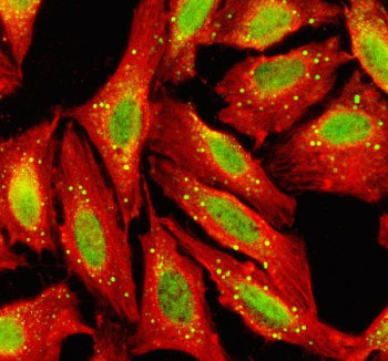 Immunofluorescent staining of TGIF2 using anti-TGIF2 antibody (green) and anti-Beta Tubulin antibody (red). TGIF2 was detected in an immunocytochemical section of U2OS cells and shows the expected nucleus and centrosome staining. Enzyme antigen retrieval was performed using IHC enzyme antigen retrieval reagent for 15 mins. The cells were blocked with 10% goat serum. And then incubated with 5 ug/ml rabbit anti-TGIF2 antibody and mouse anti-Beta Tubulin antibody overnight at 4oC.