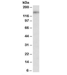 Western blot testing of mouse brain lysate with SYNGAP1 antibody at 2ug/ml. Predicted/observed molecular weight: ~148kDa.