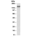 Western blot testing of mouse skeletal muscle lysate with ITGA11 antibody at 1ug/ml. Predicted molecular weight: ~133kDa.