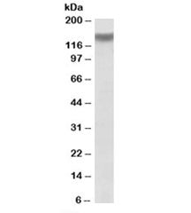 Western blot testing of mouse skeletal muscle lysate with ITGA11 antibody at 1ug/ml. Predicted molecular weight: ~133kDa.