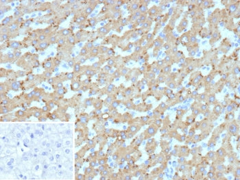 IHC staining of FFPE human hepatocellular carcinoma tissue with HSD17B13 antibody (clone HSD17B13/13110). Inset: PBS used in place of primary Ab (secondary Ab negative control). HIER: boil tissue sections in pH 9 10mM Tris with 1mM EDTA for 20 min and allow to cool before testing.