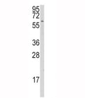 Western blot analysis of CYP1A1 antibody and K562 lysate. Predicted molecular weight ~58 kDa.