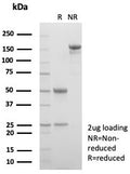 SDS-PAGE analysis of purified, BSA-free AMBP antibody (clone AMBP/4533) as confirmation of integrity and purity.