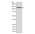 Western blot testing of human fetal liver lysate with CD41 antibody. Expected molecular weight ~120 kDa (alpha chain) and ~23 kDa (beta chain).