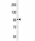 BRDT western blot analysis in MDA-MB435 lysate. Predicted molecular weight ~108 kDa.