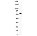 Western blot testing of 5-Lipoxygenase antibody and SGC lysate; Predicted molecular weight: ~78 kDa.