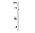 Western blot testing of human Ramos cell lysate with Pericentriolar material 1 protein antibody. Predicted molecular weight ~229 kDa.