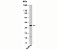 Western blot testing of human samples with GBL antibody at 1ug/ml.