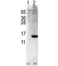 Western blot analysis of ISG15 antibody and 293 cell lysate (2 ug/lane) either nontransfected (Lane 1) or transiently transfected with ISG15 gene (2). Expected molecular weight: 15-17 kDa.