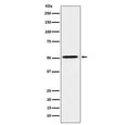 Western blot testing of human HepG2 cell lysate with HNF4 alpha antibody. Predicted molecular weight ~50 kDa.