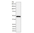 Western blot testing of human HeLa, cell lysate with ING1 antibody. Expected molecular weight ~47 kDa.