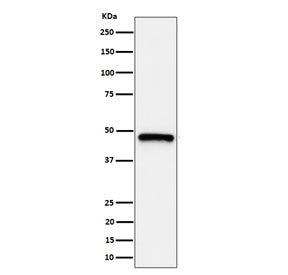 Western blot testing of human HeLa, cell lysate with ING1 antibody. Expected molecular weight ~47 kDa.