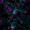 Immunofluorescent staining of frozen human cerebral cortex tissue with recombinant GFAP antibody (blue, clone ASTRO/1974R) and Histone H1 antibody (magenta, clone <a href=../tds/histone-h1-antibody-hh1-957-v2568 target=_blank>HH1/957</a>).