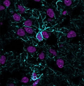Immunofluorescent staining of frozen human cerebral cortex tissue with recombinant GFAP antibody (blue, clone ASTRO/1974R) and Histone H1 antibody (magenta, clone <a href=../tds/histone-h1-antibody-hh1-957-v2568 target=_blank>HH1/957</a>).