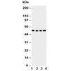 Western blot testing of Glut5 antbody; Lane 1: U87; 2: 293T; 3: HT1080; 4: SW620 cell lysate. Expected/observed molecular weight ~55 kDa.