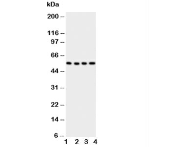 Western blot testing of Glut5 antbody; Lane 1: U87; 2: 293T; 3: HT1080; 4: SW620 cell lysate. Expected/observed molecular weight ~55 kDa.