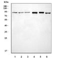 Western blot testing of 1) human HeLa, 2) human 293T, 3) human A549, 4) rat kidney, 5) mouse kidney and 6) mouse NIH 3T3 cell lysate with Fes/Fps antibody. Predicted molecular weight ~93 kDa.