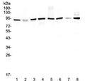 Western blot testing of human 1) HeLa 2) placenta, 3) MCF7, 4) A549, 5) SK-OV-3, 6) 22RV1, 7) A431 and 8) COLO320 lysate with UBA2 antibody at 0.5ug/ml. Predicted molecular weight: ~72 kDa but routinely observed at ~90 kDa.