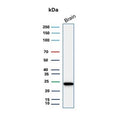Western blot testing of human brain tissue lysate with PGP9.5 antibody. Predicted molecular weight ~25 kDa.