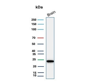Western blot testing of human brain tissue lysate with PGP9.5 antibody. Predicted molecular weight ~25 kDa.