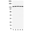 Western blot testing of ST5 antibody and Lane 1: rat testis; 2: human A431; 3: (h) HeLa; 4: (h) COLO320; 5: mouse NIH3T3 lysate. Predicted/observed molecular weight: ~126kDa.