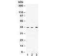 Western blot testing of 1) rat heart, 2) human HepG2 and 3) human A549 lysate with VEGFD antibody. Expected molecular weight: 40-53 kDa (pro-form), ~21 kDa (mature/active form).