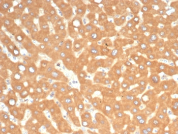 IHC staining of FFPE human liver in colon with EPH Receptor B4 antibody (clone EPHB4/6391). HIER: boil tissue sections in pH 9 10mM Tris with 1mM EDTA for 20 min and allow to cool before testing.
