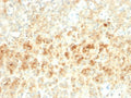 IHC testing of FFPE human adrenal tissue with recombinant Adipophilin antibody (clone ADFP/2755R). Required HIER: steam sections in pH6, 10mM citrate buffer for 10-20 min.