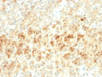 IHC testing of FFPE human adrenal tissue with recombinant Adipophilin antibody (clone ADFP/2755R). Required HIER: steam sections in pH6, 10mM citrate buffer for 10-20 min.