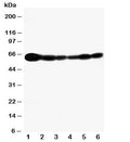 Western blot testing of SHC antibody and Lane 1: rat brain; and human samples 2: A549; 3: A431; 4: 293T; 5: HeLa; 6: Jurkat cell lysate. Predicted molecular weight ~63kDa.