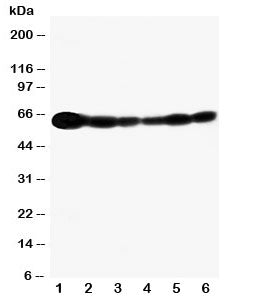 Western blot testing of SHC antibody and Lane 1: rat brain; and human samples 2: A549; 3: A431; 4: 293T; 5: HeLa; 6: Jurkat cell lysate. Predicted molecular weight ~63kDa.
