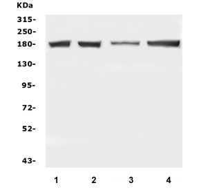 Western blot testing of human 1) U-87 MG, 2) U-2 OS, 3) A431 and 4) A549 cell lysate with DCC antibody. Expected molecular weight: 155~190 kDa depending on glycosylation level.