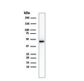 Western blot testing of human HCT-116 cell lysate with recombinant Cytokeratin 8 antibody (clone KRT8/2174R).