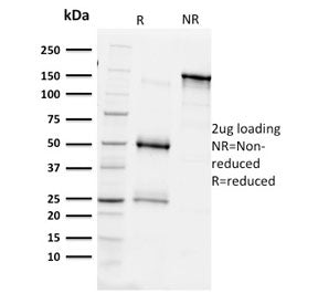 SDS-PAGE analysis of purified, BSA-free BAP1 antibody (clone BAP1/2431) as confirmation of integrity and purity.