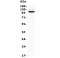 Western blot testing of human HepG2 cell lysate with MTTP antibody. Predicted molecular weight ~99 kDa.