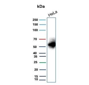 Western blot testing of human HeLa cell lysate with recombinant Carbonic Anhydrase IX antibody. Predicted molecular weight: 50-55 kDa but may be observed at higher molecular weights due to glycosylation.