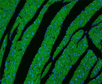 Immunofluorescent staining of FFPE mouse heart tissue with CPT1B antibody (green) and DAPI nuclear stain (blue). HIER: steam section in pH8 EDTA buffer for 20 min.