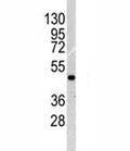 Western blot analysis of ILK1 antibody and NCI-H460 lysate. Expected molecular weight: 51-59 kDa.
