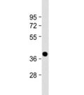 Western blot testing of human heart lysate with NMNAT1 antibody at 1:2000. Predicted molecular weight: 32 kDa.