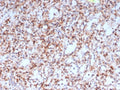 IHC staining of FFPE human spleen tissue with RETN antibody (clone RETN/4327). HIER: boil tissue sections in pH 9 10mM Tris with 1mM EDTA for 20 min and allow to cool before testing.