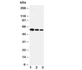 Western blot testing of Fetuin-A antibody and Lane 1: recombinant human protein 10ng; 2: 5ng; 3: 2.5ng